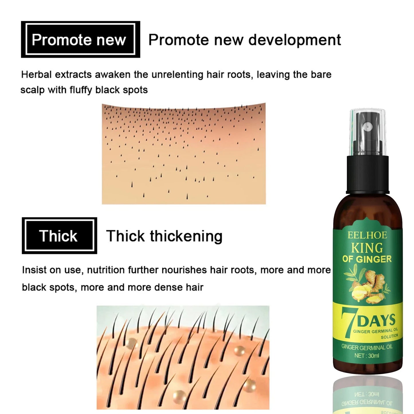 Ginger Hair Growth Serum Spray - Nourishing Scalp Treatment for Stronger Roots, Shine & Hair Care