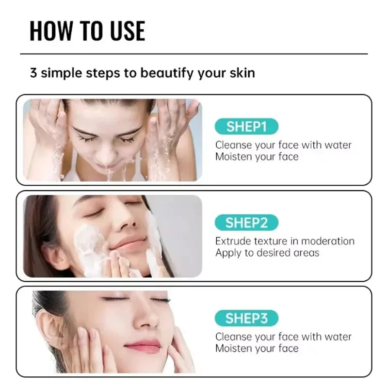 Effective Acne Removal Cream 30g – Anti-Acne Gel for Redness, Pimples, Deep Pore Cleaning & Oil Control Skin Care