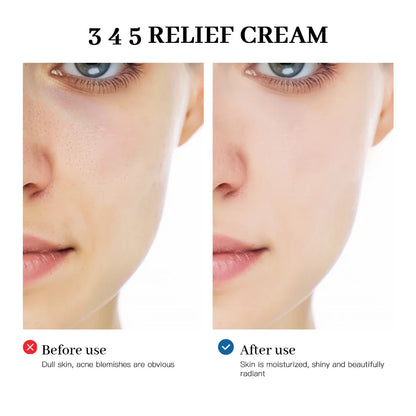 345 Relief Cream — Anti-Aging, Brightening & Acne Scar Repair Skincare