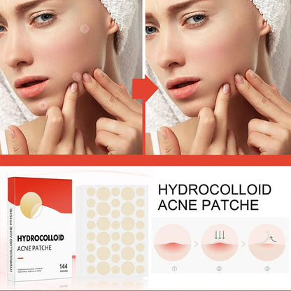 144pcs Face Acne Pimple Patch Set – 2 Sizes Invisible Professional Healing Spot Stickers for Men & Women Skin Care