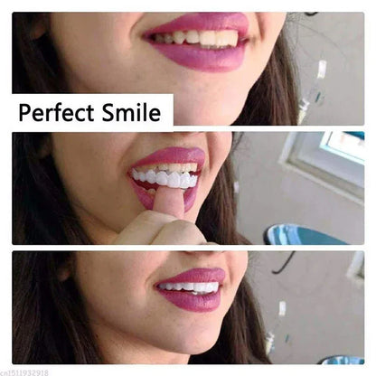 White Fake Teeth Cover – Whitening & Interdental Gap Decor, Portable Braces for Aesthetic Dental Beauty