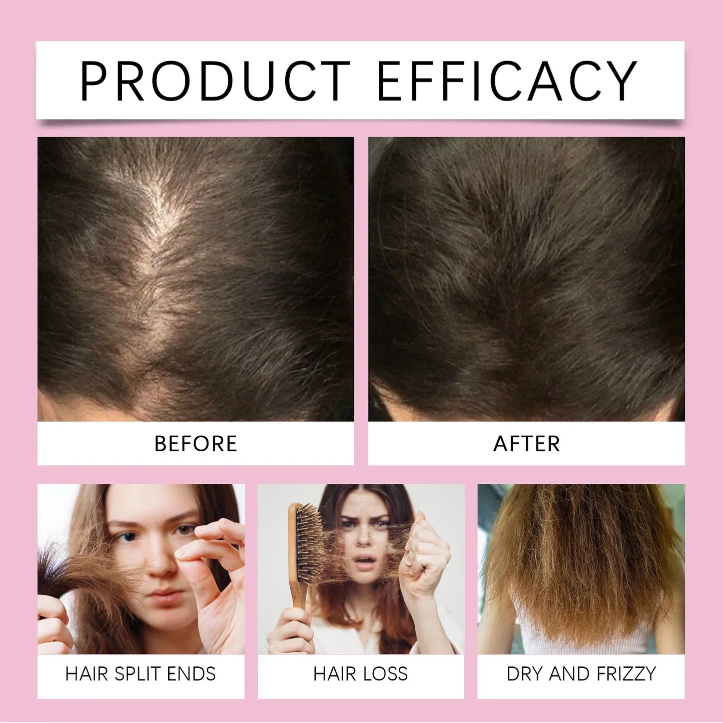 Rosemary Care Hair Essential Oil - Hair Growth Strengthening Scalp Treatment for Dry Hair, Split Ends & Hair Loss Prevention