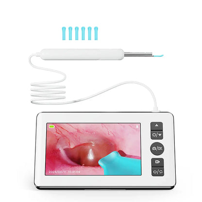 GUANMOU Digital Otoscope – 3.9mm Ear Scope Camera with 6 LED Lights, 4.3" IPS Ear Wax Removal Tool for Kids & Adults