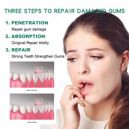 Gum Repair Oral Care Drops - Periodontal Hygiene Treatment for Gum Cleaning & Stain Removal