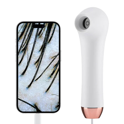 Multifunctional HD Scalp & Skin Analyzer — Hair Follicle Detector with Magnifier for Phone & Tablet