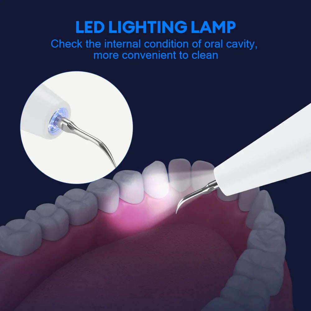 Ultrasonic Dental Plaque & Calculus Remover – Teeth Tartar Eliminator, Stains Cleaner, Electric Tooth Stone Scaler
