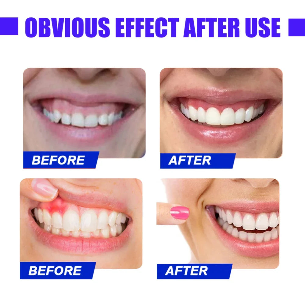 Red Light Therapy Device – Fast Relief for Tooth Pain & Gum Sensitivity