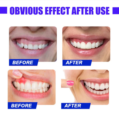 Red Light Therapy Device – Fast Relief for Tooth Pain & Gum Sensitivity