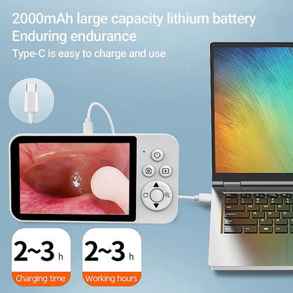 GUANMOU Digital Otoscope – 3.9mm Ear Scope Camera with 6 LED Lights, 4.3" IPS Ear Wax Removal Tool for Kids & Adults