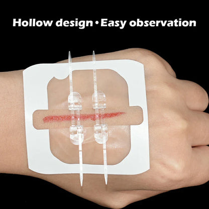 Camping Wound Closure Strips – Painless Adhesive Suture Patch for Fast Hemostatic Care & First Aid